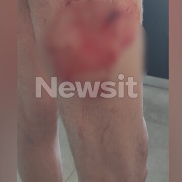 Από την επίθεση στον 71χρονο