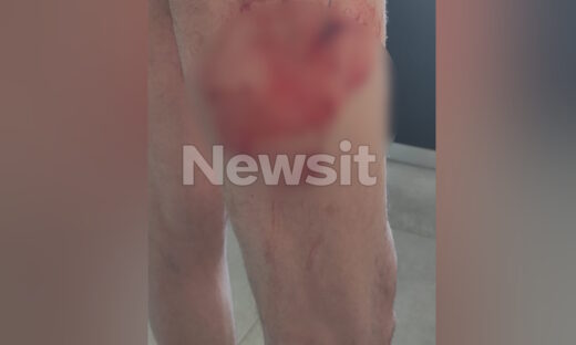 Από την επίθεση στον 71χρονο