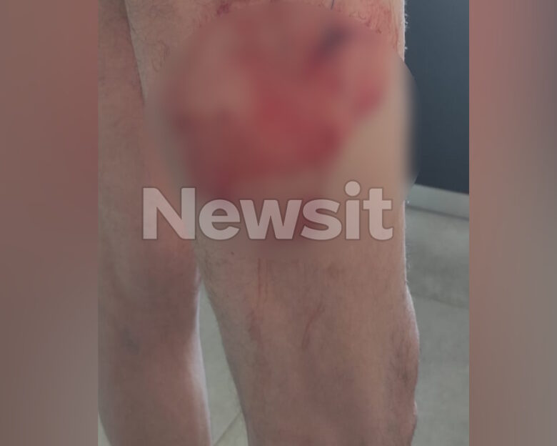 Ο σκύλος της οικογένειας Τσιτσιπά επιτέθηκε σε ηλικιωμένο έξω από καφετέρια – Είχε επιτεθεί ξανά το 2023 σε μαθητή