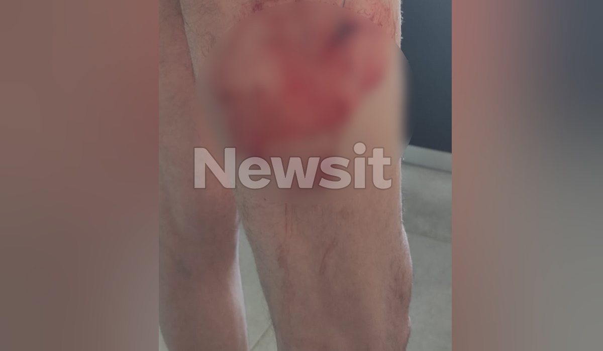 Από την επίθεση στον 71χρονο