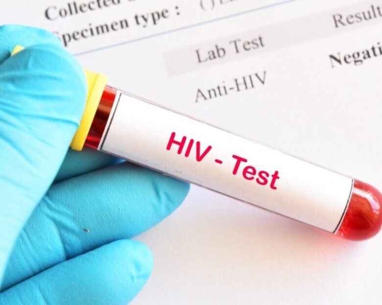 Νέα εποχή στη μάχη με τον ιό HIV: Οι ΗΠΑ ενέκριναν φάρμακο που θα μπορούσε να σταματήσει τη μετάδοση