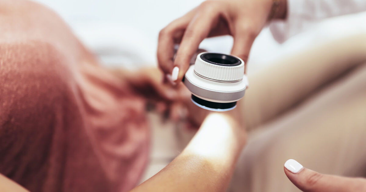 What you need to know about skin cancer