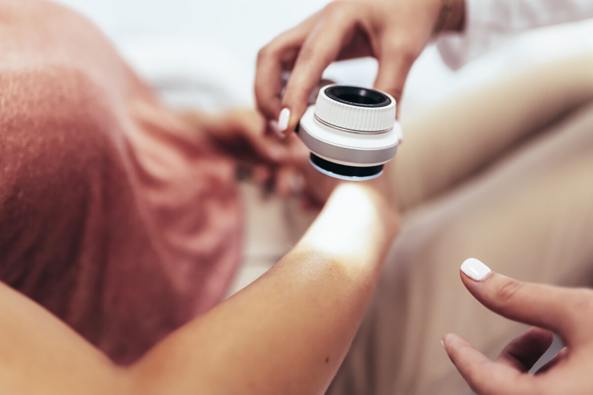 The dermatologist examines the moles or acne of the patient with a dermatoscope. Prevention of melanoma
