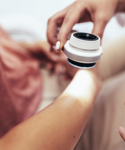 The dermatologist examines the moles or acne of the patient with a dermatoscope. Prevention of melanoma