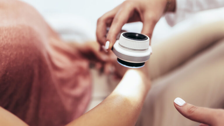 The dermatologist examines the moles or acne of the patient with a dermatoscope. Prevention of melanoma