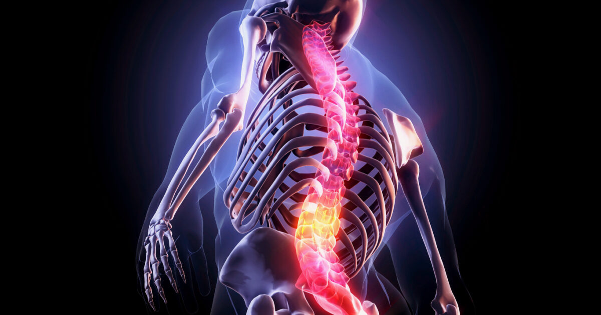 Spine Stenosis: Treatment with minimally invasive techniques