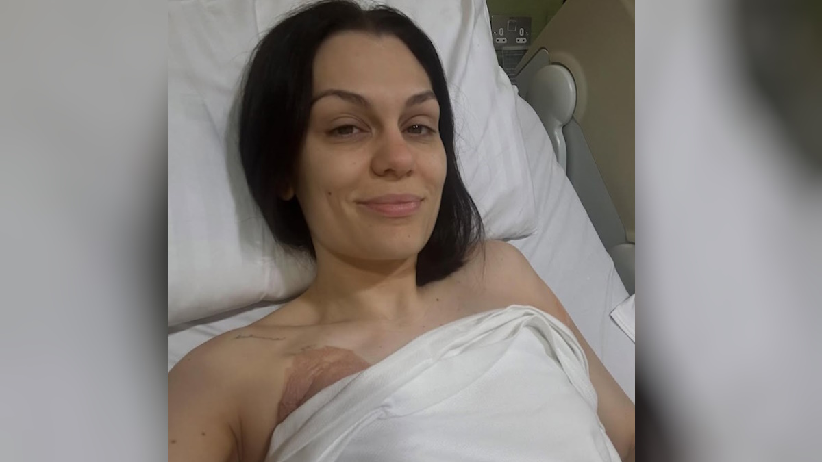 Η Jessie J