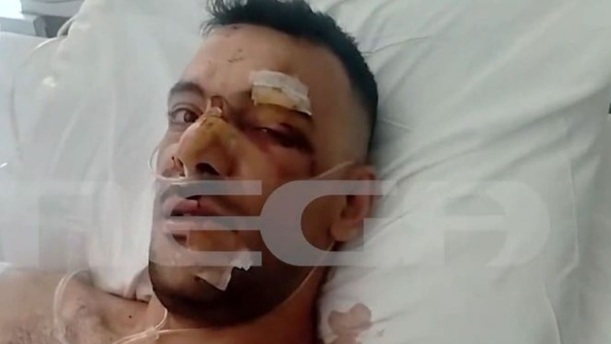 Το θύμα της σοκαριστικής επίθεσης στη Μυτιλήνη