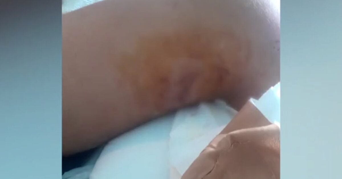 Petersburg: Shocked by the 15 -year -old father who was stabbed in the bus – “He had fainted and kicked him in the face”