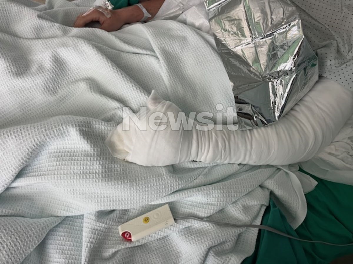 Ο νεαρός ψυκτικός φέρει τραύματα και στο αριστερό του χέρι 