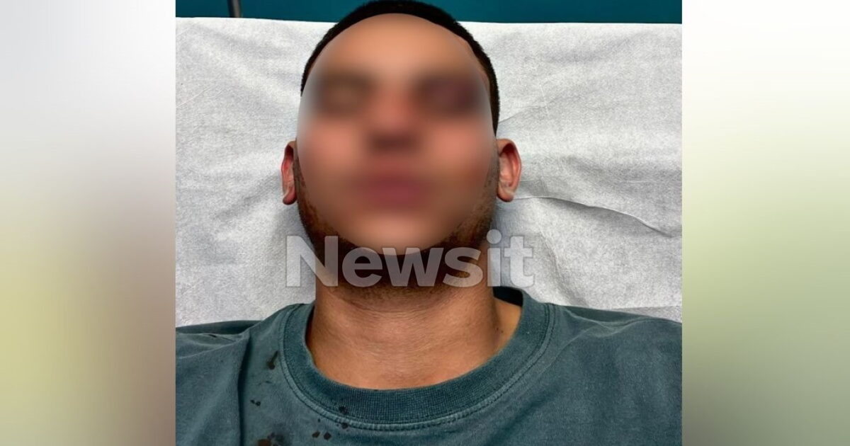 Chalkida: “The 19 -year -old hit me in the head with a friend” says the 18 -year -old who stunned his peer