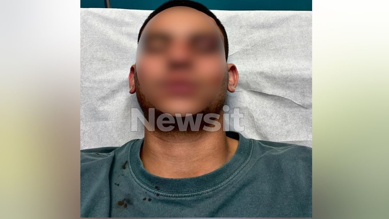 Το θύμα ξυλοδαρμού στη Χαλκίδα