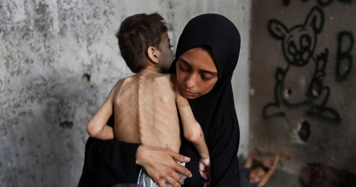 Gaza: Stomach punch the images with malnourished children – “Almost a man in three does not eat for days,” says WFP