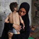Η παλαιστίνια, Samah Matar κρατάει τον υποσιτισμένο γιο της Youssef, ο οποίος πάσχει από εγκεφαλική παράλυση