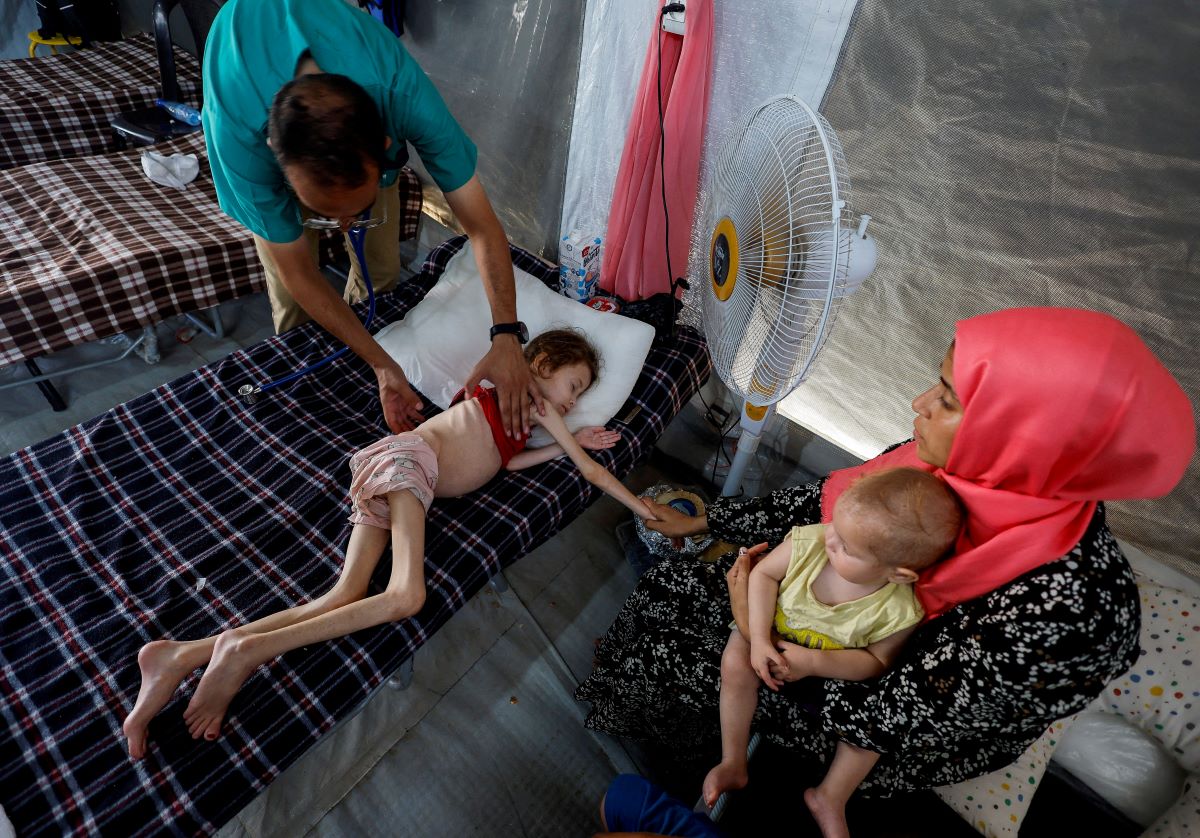 Doctor examines Jana Ayad, a malnourished Palestinian as she receives hospital treatment