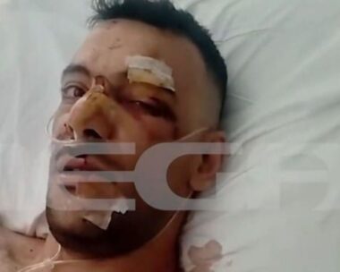 Το θύμα της σοκαριστικής επίθεσης στη Μυτιλήνη
