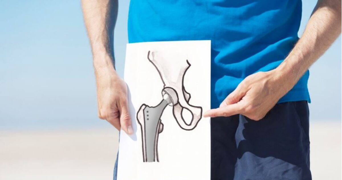 Modern Hip Arthroplasty Techniques: The Benefits of Personalized Solutions