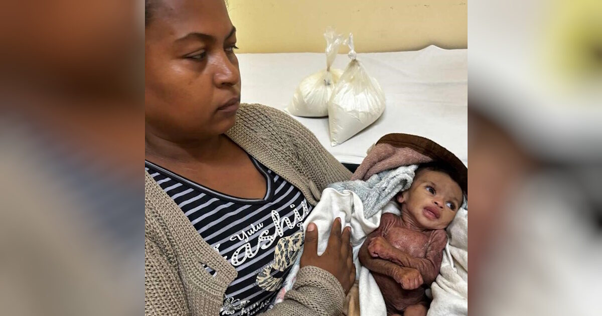 In Madagascar they let one of the twins die – the fight of two Greeks to save all children