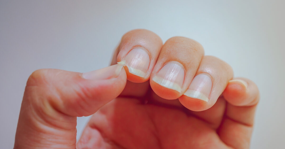 5+1 food to have loud and healthy nails – what do experts suggest