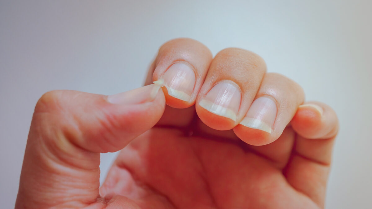The nail at the index finger tear. Cause pain at the fingertips.