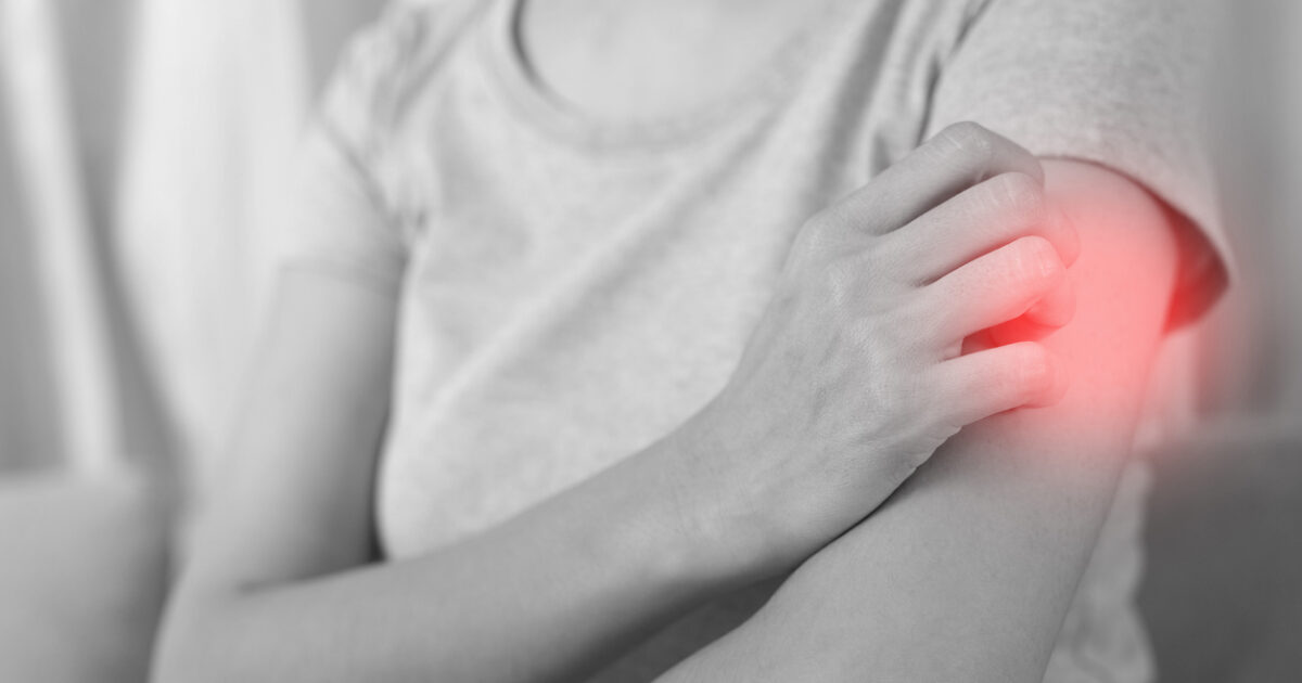When are hormones to blame for eczema outbursts