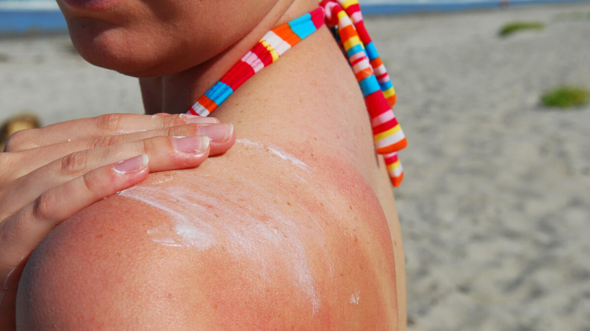 A woman applies sunblock at the beach