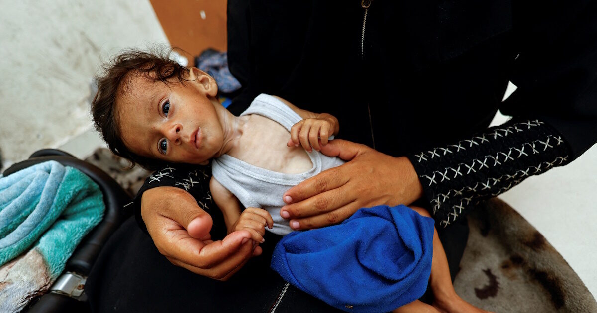 Gaza: Father who lost his son from malnutrition struggles to save his other children – “We don’t live, we are late”
