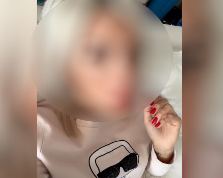 Θέρμη: Μετά από 1,5 ώρα ενημερώθηκαν οι αρχές για το τροχαίο – «Είχα απώλεια μνήμης» λέει η οδηγός της Porsche