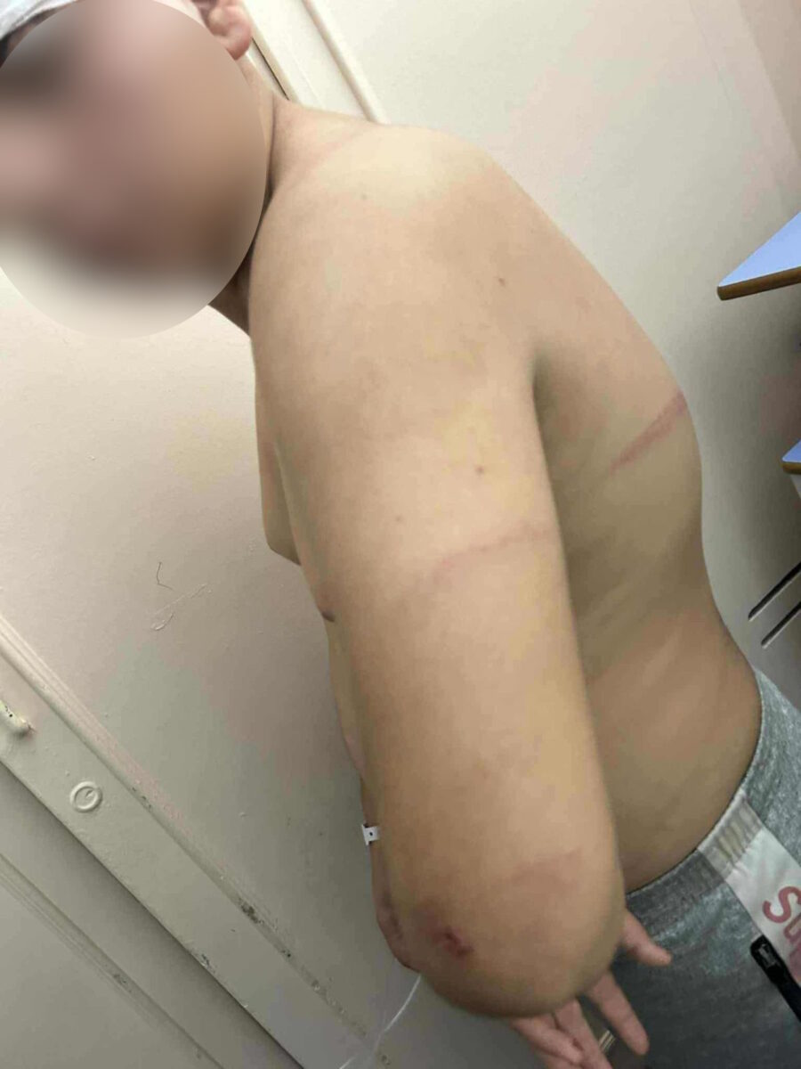 Ο 13χρονος που έπεσε θύμα επίθεσης