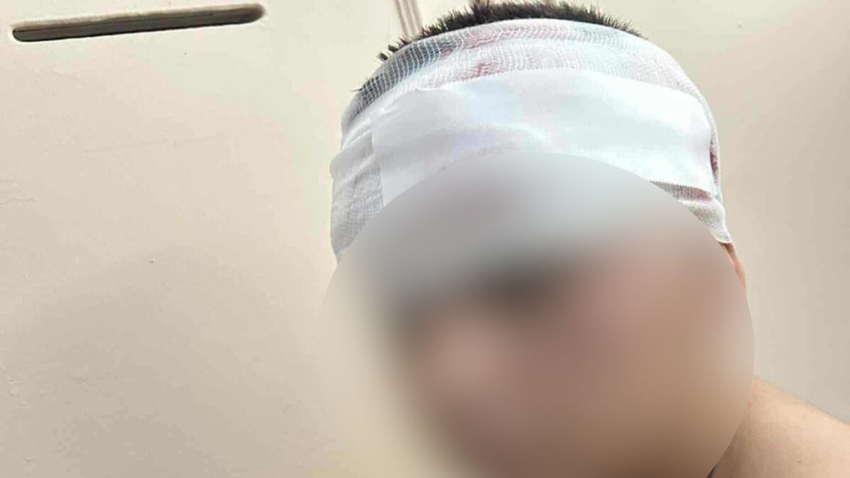 Ο 13χρονος που έπεσε θύμα επίθεσης