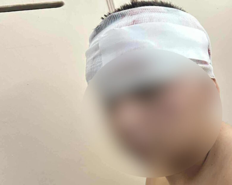 Θεσσαλονίκη: Σοκάρει ο πατέρας του 13χρονου που έπεσε θύμα ξυλοδαρμού – «Είναι γεμάτος τρύπες 15 πόντων στο κεφάλι»