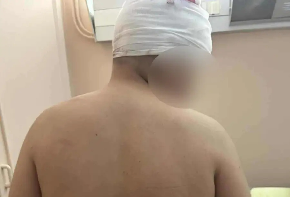 Τραυματισμένος 13χρονος