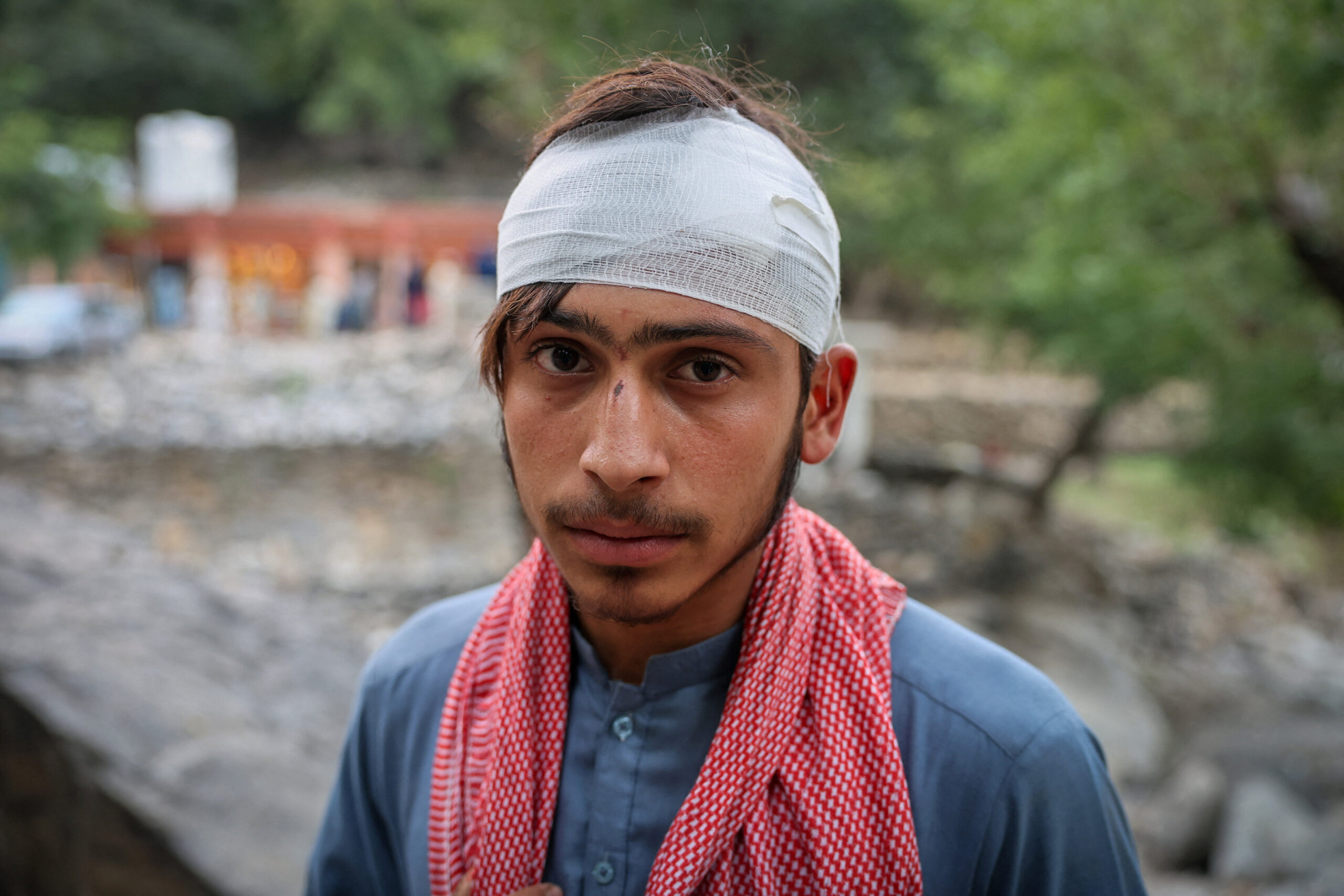 An injured by earthquake in Afghanistan