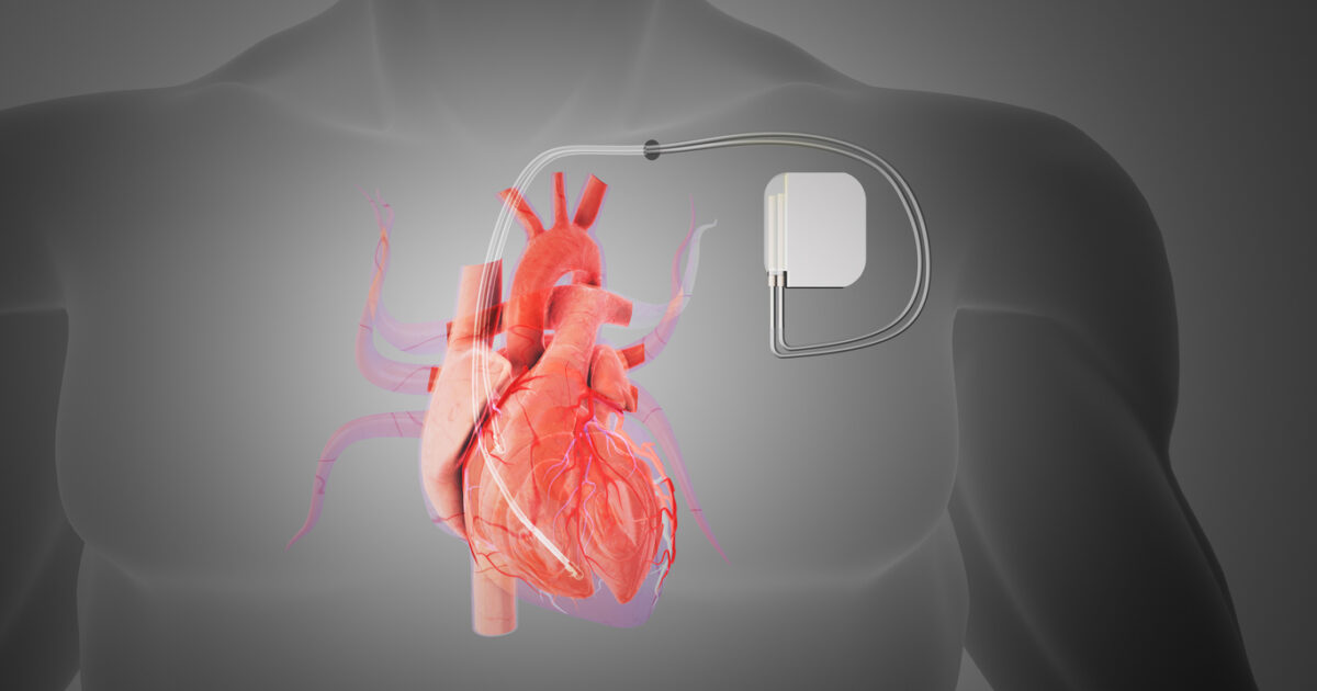 How safe is the use of electronic devices by patients with pacemaker – defibrillator?