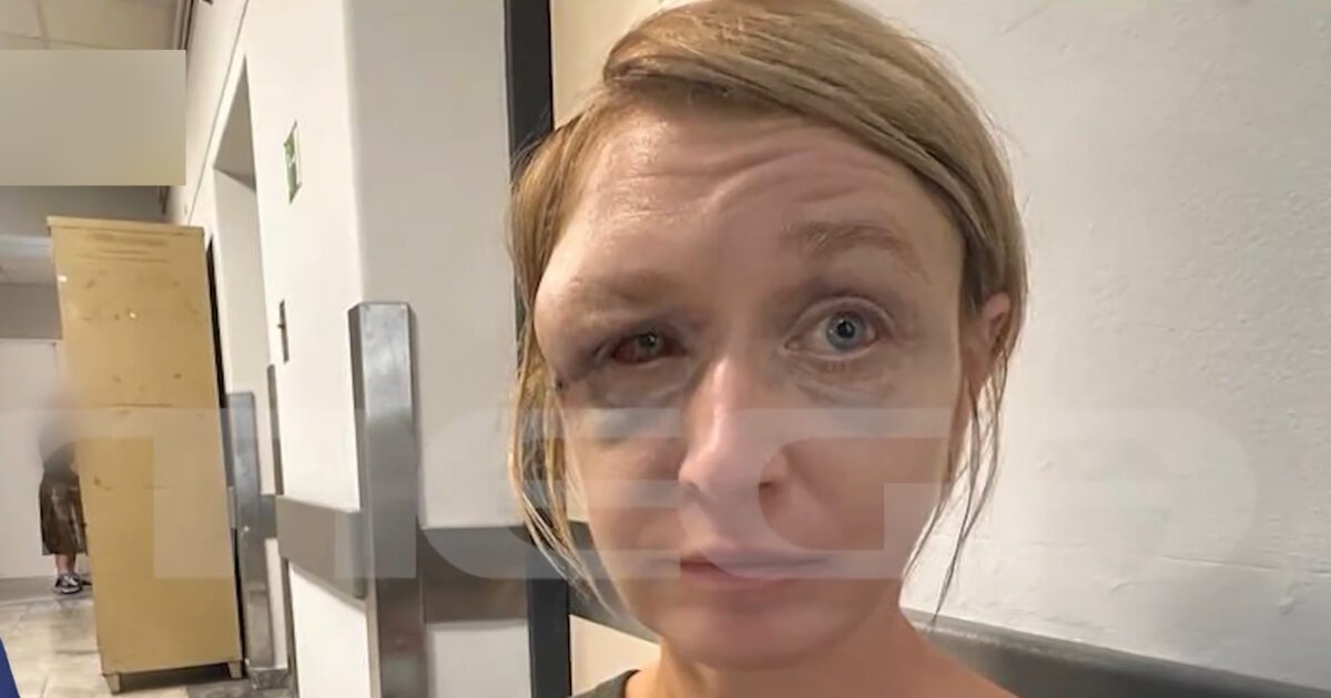 Koropi: “We have a love relationship with my partner” says the 40-year-old who was beaten – Her image after the abuse is shocking