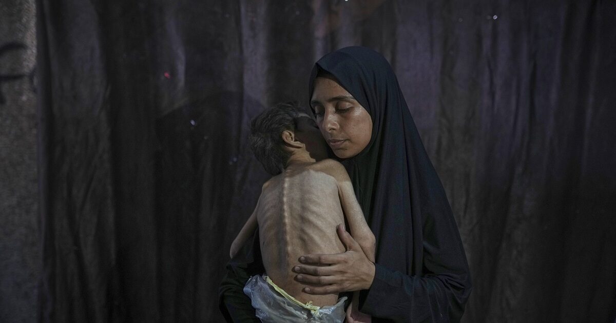 Gaza’s malnutrition alarm by NGOs “Doctors of the World” and “Action Against Hunger”
