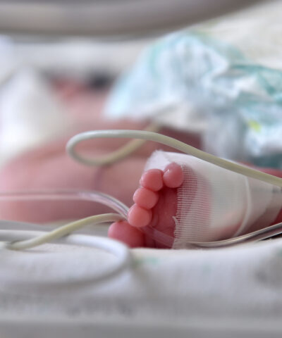 Newborn baby with cannula in the feet on a hospital bed