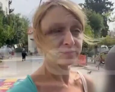 Η 40χρονη, θύμα ξυλοδαρμού από τον σύντροφό της στο Κορωπί