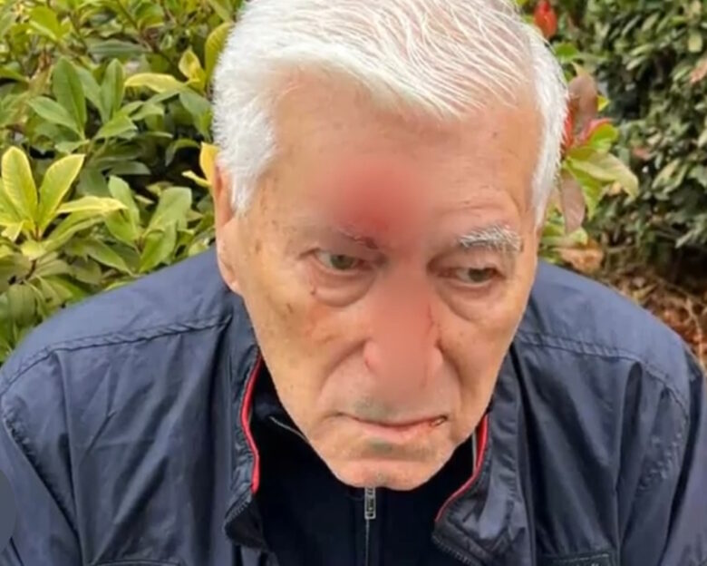 Θεσσαλονίκη: 82χρονος δέχτηκε επίθεση από γιατρό «μποξέρ» – «Μου είπε ότι του χτύπησα το αμάξι και μου έδωσε 2 μπουνιές»