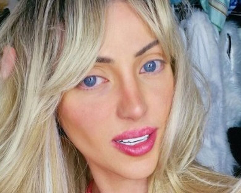 Βραζιλία: Νεκρή influencer που έκανε 27 πλαστικές επεμβάσεις για να μοιάσει στη Barbie