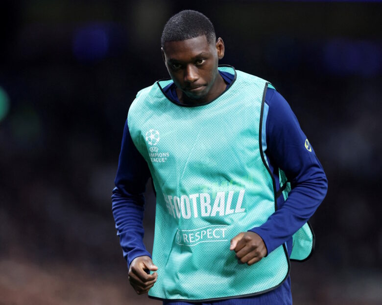 Εκτός Εθνικής Γαλλίας ο Κόλο Μουανί λόγω κατάγματος στη γνάθο