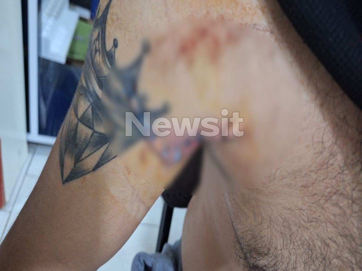 Τα τραύματα του 30χρονου