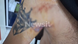 Τα τραύματα του 30χρονου