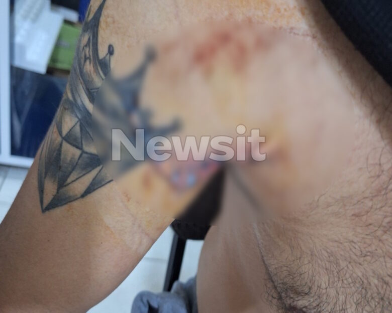 Θεσσαλονίκη: «Μια μέρα πριν το έγκλημα είχε σπάσει τις κάμερες, είχε σχεδιασμένη τη δολοφονία», λέει ο 30χρονος γιος της 60χρονης που σκότωσε ο 47χρονος