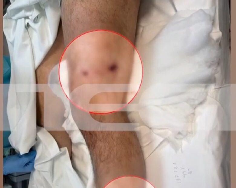 Βορίζια: Νέες φωτογραφίες από το μακελειό – Άφαντα παραμένουν τα όπλα της αιματοχυσίας