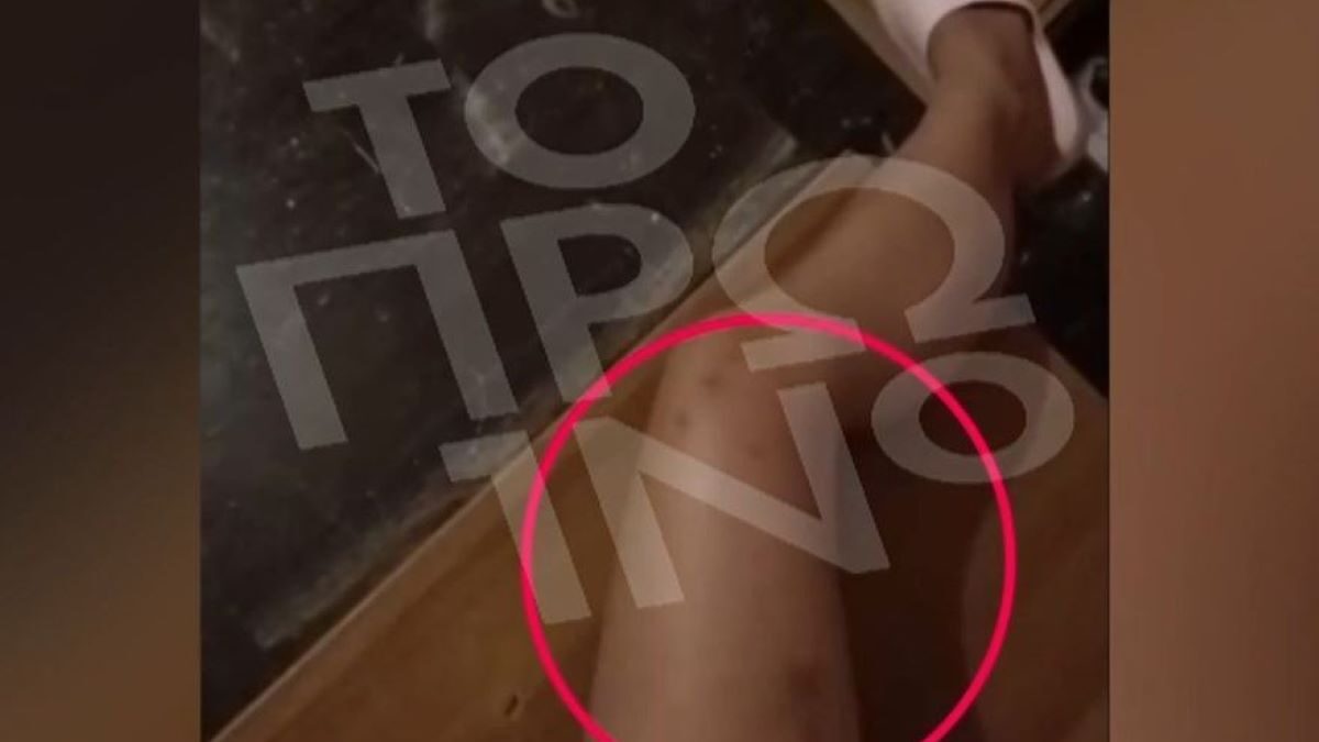 Άγριος ξυλοδαρμός 19χρονης από τον πρώην σύντροφό της