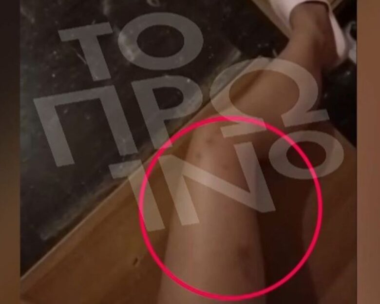 19χρονη καταγγέλλει τον 25χρονο πρώην σύντροφό της για ξυλοδαρμό – «Γιατί με χτύπησες, πονάω»