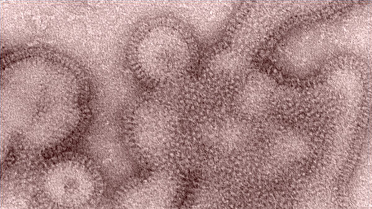 Το επικίνδυνο στέλεχος γρίπης Α(H3N2)