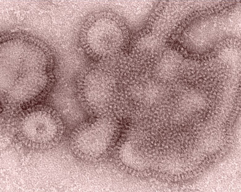 Συναγερμός στη Βρετανία για τη μεταλλαγμένη «σούπερ γρίπη: Τι είναι το στέλεχος H3N2, επιστρέφουν μνήμες από την εποχή του COVID-19