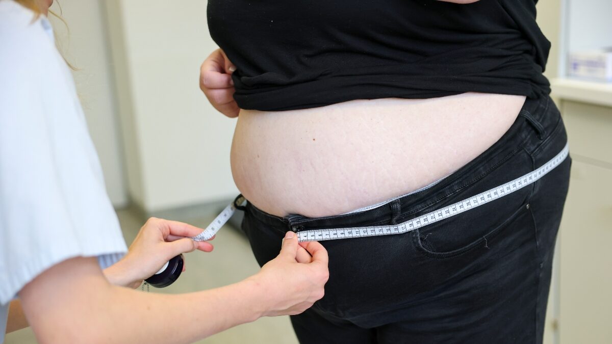 Παχυσαρκία